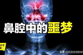 当你爆发过敏性鼻炎时，这就是你体内发生的故事图片