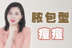 脸上长脓包痘痘怎么办，有脓包的痘痘要挤吗？