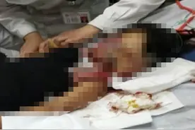 河北保定载老板出车祸男子女儿被打进ICU，多位村民称：打人者已喝农药自杀图片