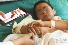 接臂手术第五天，小男孩伤臂渐渐消肿图片