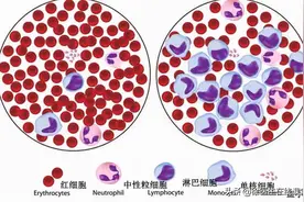 越来越多孩子得白血病，家长注意：孩子有3大异常，需及时排查图片