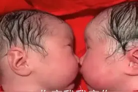 龙凤胎兄妹出生后一直亲吻，护士都没法分开，画风太腻歪了图片