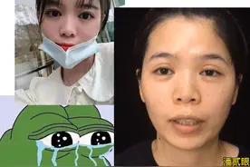 河南姑娘亲历：整形成功后“漂亮得像个渣女”是一种怎样的体验？图片