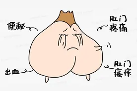 肛门疼痛、瘙痒、出血，到底是痔疮还是肛裂？图片