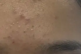 知道这些护肤知识，脸上出现瑕疵，就不用干着急了图片