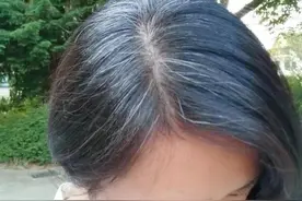 女子白头发日渐增多，别总觉得老了，或是缺了这3大营养素图片