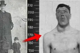 生长激素过剩会怎么样？一个生为侏儒，死为巨人的疯狂故事图片