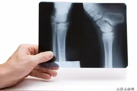 医疗纠纷：医科大学附属医院，术前禁忌用药未提醒致患者六级伤残图片