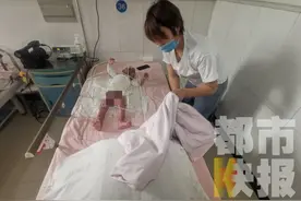 救救她！陕西一女婴掉入煮酒锅中烧伤，4次与死神擦肩而过图片