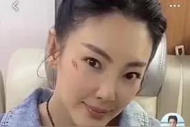 张雨绮都diss的超声刀手术问题，让德国功效冻龄精华来解决图片