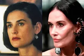 明星整容前后对比照！用钱砸出来的脸羡慕还是批判？图片