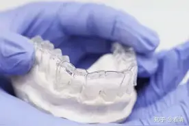 戴牙套是种什么体验？图片