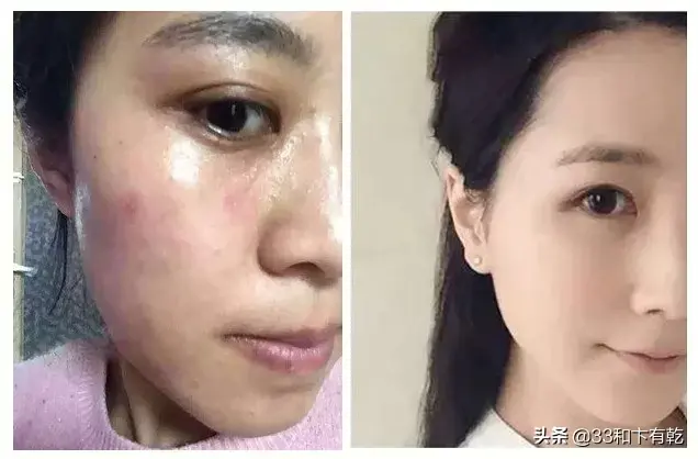 火爆INS的芝士皂，洗脸就像敷面膜，痘痘，黑头，螨虫全都消失了