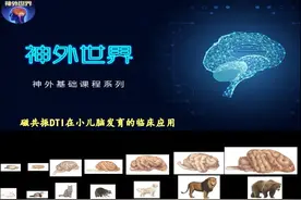 磁共振DTI脑白质纤维束解剖与临床|DTI纤维束在小儿脑发育的应用图片