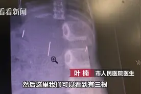 父母用缝衣针吓唬式教育2岁宝宝，结果肠子都悔青了图片