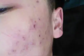 “零差评”男士控油护肤品排行榜，油痘肌的男生本命洗面奶推荐图片