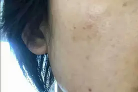 长斑不知怎么办？别急，看完这篇，祛斑还是难事儿？图片