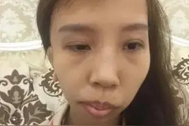 女子因嘴歪被丈夫抛弃，如今做数次整容变漂亮，前夫后悔不已图片