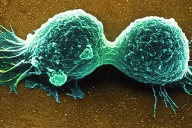 查出癌症后都活不过几个月？癌细胞发展的速度快吗，如何预防？图片