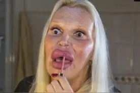 意大利男子变性后经过150次整容，终于把自己变成一位漂亮女人图片