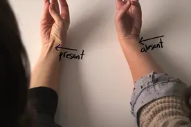 人身上有哪些毫无作用，但依旧存在的器官？它们为什么没有消失？图片