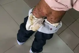 10岁女孩长期遭家暴！合肥警方深夜发声！目前女孩暂已由奶奶照顾图片