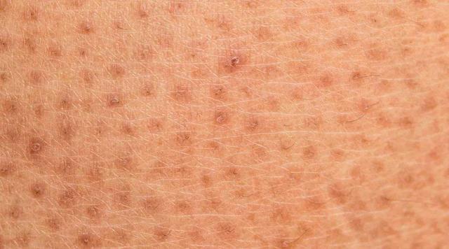 毛周角化能做海藻换肤吗