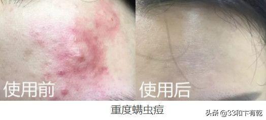 火爆INS的芝士皂，洗脸就像敷面膜，痘痘，黑头，螨虫全都消失了