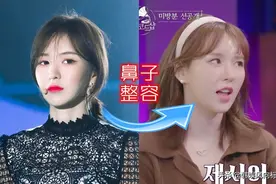 红贝贝的Wendy被指做了鼻子整形手术，粉丝：请不要负评图片