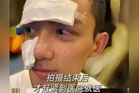吴磊拍戏脸部炸伤，全程安慰道具师不抱怨，网友：给年轻演员打样图片