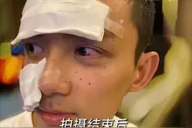 吴磊拍戏脸部炸伤，全程安慰道具师不抱怨，网友：给年轻演员打样图片