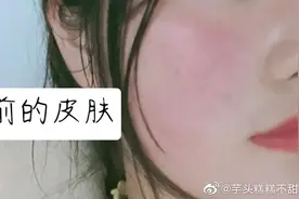 皮肤对你发出的求救信号❗️（上）图片