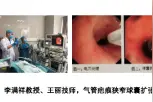 西安交通大学第一附属医院呼吸与危重症医学科介入诊治技术在发展图片