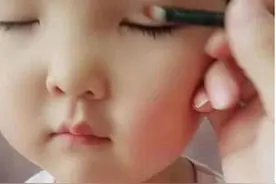孩子不是双眼皮，家长亲自给整成双眼皮，网友：无知图片