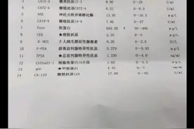 刘懿博士说肺癌（二二亖二）体检异常怕肺癌，刘主任，我太害怕了图片
