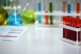 测了个寂寞？儿童微量元素检测被“叫停”背后图片