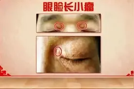 疾病来临前，身体这些地方会“露出马脚”，再小的变化也别忽视！赶紧对照自查图片