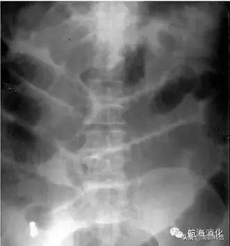 涓撳璇达細鍏充簬鑲犳闃荤殑14涓棶棰? onerror=