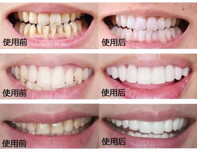 涓€娆惧彿绉?鈥滀笂甯濆垱閫犵殑鐗欒啅鈥?姊呭ゥ鍖婚櫌閮芥槸鎸囧畾瀹?缃戝弸锛氫竾鑳? onerror=