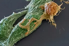 不常见的细胞吞噬图片，像极了传世油画图片