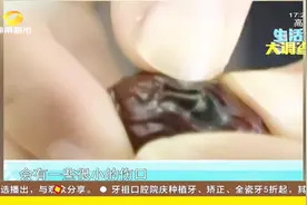 鲜枣表面通红，一晒出现黑斑，这样的枣还能吃吗？视频封面