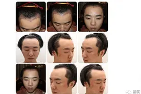 已经被情人锤成这样了！华晨宇，承认整形有那么丢脸吗？图片