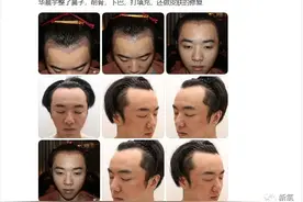 已经被情人锤成这样了！华晨宇，承认整形有那么丢脸吗？图片
