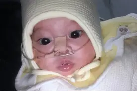 男婴刚出生就进ICU，8个月经历两次手术，大眼睛让人过目难忘图片