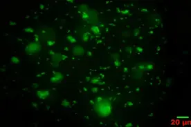 北京协和医院超声医学科杨萌发表于ULTRASOUND MED BIOL的研究图片