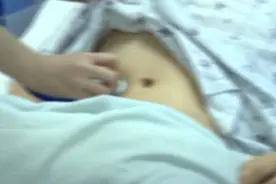 把白酒当水喝？男子豪饮6天，肠道数次“血崩”险些丧命图片