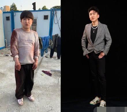 脂肪瘤很大怎么办