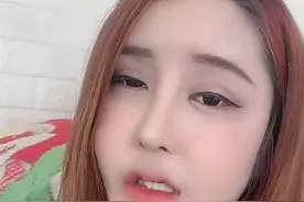 网红整容又失败，花费百万额头却现巨坑，曾面部神经遭压迫险失明图片