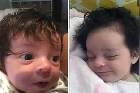 女孩打娘胎就有一头秀发，每次出门回头率爆表，光头爸爸：随我图片