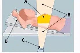 乳腺放疗后 护理怎么做图片